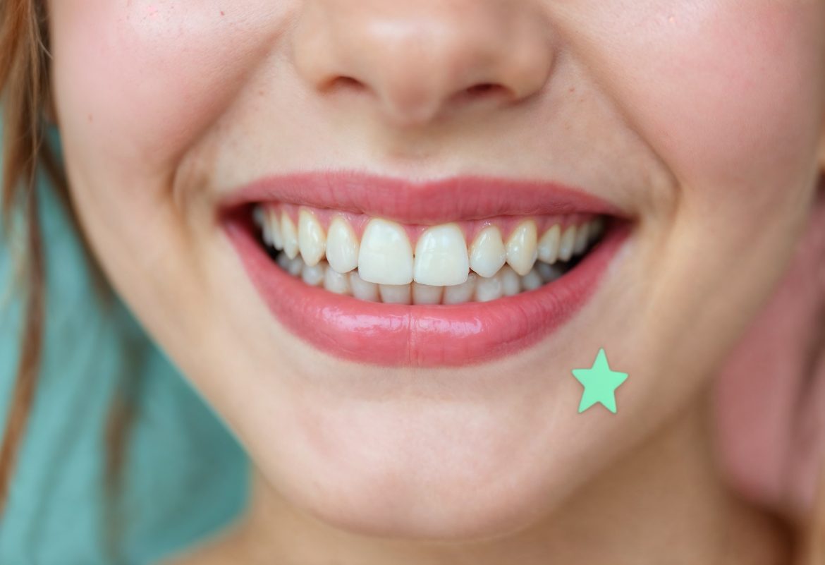 Whitening Toothpaste, Whitening Strips or Professional Whitening: Which One Really Works?